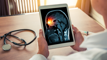 ¿Cómo prevenir la meningitis? Consejos y cuidados