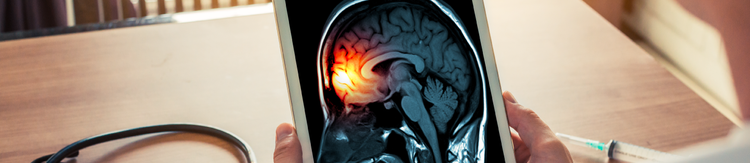 ¿Cómo prevenir la meningitis? Consejos y cuidados